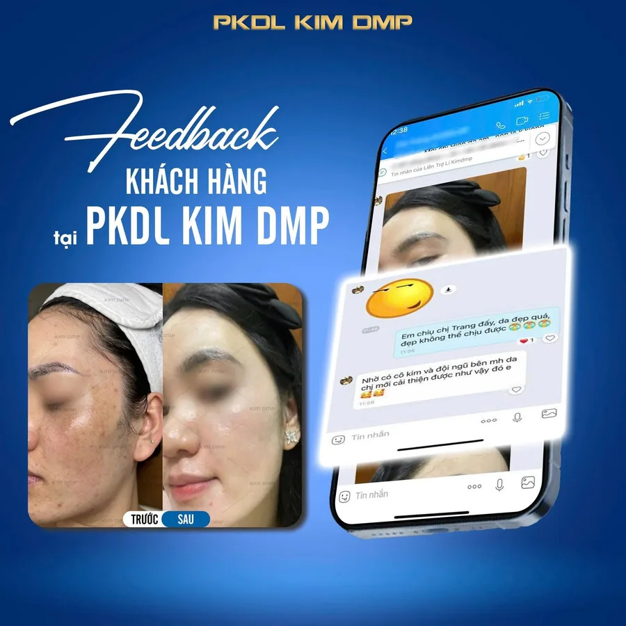 Phản hồi của khách hàng gửi về Kim DMP